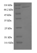 Greater than 90% as determined by SDS-PAGE.Recombinant Human Peroxisome Proliferator-Activated Receptor Gamma (PPARG) Protein (His-SUMO)