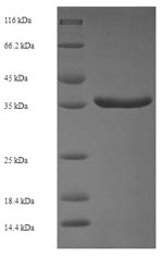 Greater than 90% as determined by SDS-PAGE.Recombinant Human Protein Phosphatase 1B (PPM1B) Protein (His-SUMO)