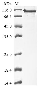 Greater than 85% as determined by SDS-PAGE.Recombinant Human Protein Phosphatase 1 Regulatory Subunit 15A (PPP1R15A) Protein (His)