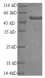 Greater than 90% as determined by SDS-PAGE.Recombinant Human Melanoma Antigen Preferentially Expressed In Tumors (PRAME) Protein (His)