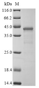 Greater than 85% as determined by SDS-PAGE.Recombinant Human Basic Salivary Proline-Rich Protein 1 (PRB1) Protein (His-GST)