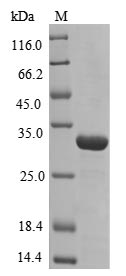 Greater than 85% as determined by SDS-PAGE.Recombinant Human Peroxiredoxin-1 (PRDX1) Protein (His)