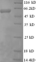 Greater than 90% as determined by SDS-PAGE.Recombinant Human Perforin-1 (PRF1) Protein (His-SUMO)