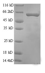 Greater than 90% as determined by SDS-PAGE.Recombinant Rat Perforin-1 (PRF1) Protein (His)