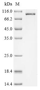 Greater than 90% as determined by SDS-PAGE.Recombinant Human Protein Kinase C Eta Type (PRKCH) Protein (His)