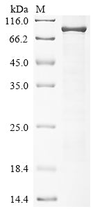 Greater than 85% as determined by SDS-PAGE.