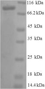 Greater than 90% as determined by SDS-PAGE.Recombinant Human Vitamin K-Dependent Protein S (PROS1) Protein (His-SUMO)