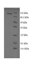 Greater than 90% as determined by SDS-PAGE.Recombinant Rat Vitamin K-Dependent Protein S (PROS1) Protein (GST)