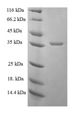 Greater than 90% as determined by SDS-PAGE.Recombinant Human Proactivator Polypeptide (PSAP) Protein (GST)