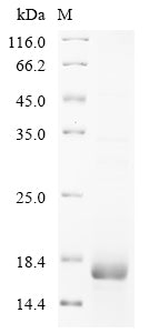 Greater than 85% as determined by SDS-PAGE.Recombinant Human Prostate Stem Cell Antigen (PSCA) Protein (His)
