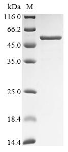 Greater than 85% as determined by SDS-PAGE.Recombinant Human Pregnancy-Specific Beta-1-Glycoprotein 1 (PSG1) Protein (His)