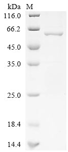 Greater than 85% as determined by SDS-PAGE.Recombinant Human Proteasome Activator Complex Subunit 3 (PSME3) Protein (His-GST)