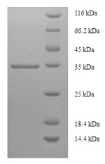 Greater than 90% as determined by SDS-PAGE.Recombinant Human Prostaglandin-H2 D-Isomerase (PTGDS) Protein (His-SUMO)
