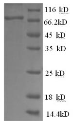 Greater than 90% as determined by SDS-PAGE.Recombinant Human Prostaglandin G/H Synthase 2 (PTGS2) Protein (His)