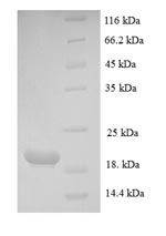 Greater than 90% as determined by SDS-PAGE.Recombinant Human Parathyroid Hormone-Related Protein (PTHLH) Protein (His)