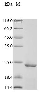 Greater than 85% as determined by SDS-PAGE.Recombinant Human Parathymosin (PTMS) Protein (His&Myc)