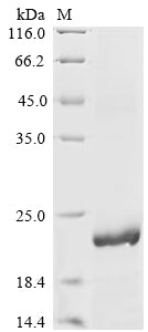 Greater than 85% as determined by SDS-PAGE.Recombinant Rat Pleiotrophin (PTN) Protein (His)