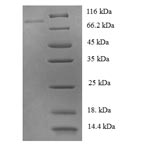 Greater than 90% as determined by SDS-PAGE.Recombinant Human Tyrosine-Protein Phosphatase Non-Receptor Type 6 (PTPN6) Protein (His-SUMO)