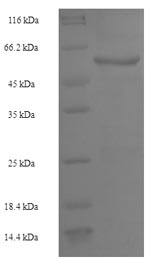 Greater than 90% as determined by SDS-PAGE.Recombinant Human Receptor-Type Tyrosine-Protein Phosphatase Beta (PTPRB) Protein (His-SUMO)