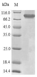 Greater than 90% as determined by SDS-PAGE.Recombinant Human Receptor-Type Tyrosine-Protein Phosphatase C (PTPRC) Protein (His-SUMO)