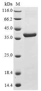 Greater than 85% as determined by SDS-PAGE.Recombinant Mouse Receptor-Type Tyrosine-Protein Phosphatase S (PTPRS) Protein (His&Myc)