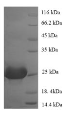 Greater than 90% as determined by SDS-PAGE.