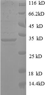 Greater than 90% as determined by SDS-PAGE.Recombinant Human T Pyrroline-5-Carboxylate Reductase 1, Mitochondrial (PYCR1) Protein (His-SUMO)