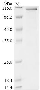 Greater than 85% as determined by SDS-PAGE.Recombinant Human Glycogen Phosphorylase, Brain Form (PYGB) Protein (His&Myc)