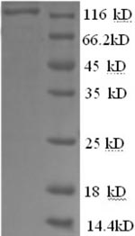 Greater than 90% as determined by SDS-PAGE.Recombinant Human Glycogen Phosphorylase, Liver Form (PYGL) Protein (GST)