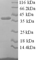 Greater than 90% as determined by SDS-PAGE.Recombinant Human Pregnancy Zone Protein (PZP) Protein (His)