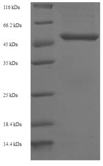 Greater than 90% as determined by SDS-PAGE.Recombinant Human Glutaminyl-Peptide Cyclotransferase (QPCT) Protein (His-SUMO)