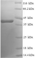 Greater than 90% as determined by SDS-PAGE.Recombinant Human Ras-Related Protein Rab-5A (RAB5A) Protein (His-SUMO)