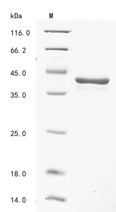 Greater than 85% as determined by SDS-PAGE.Recombinant Human Dna Repair Protein Rad51 Homolog 1 (RAD51) Protein (His)