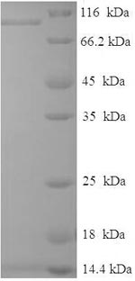 Greater than 90% as determined by SDS-PAGE.