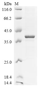 Greater than 85% as determined by SDS-PAGE.Recombinant Mouse Dexamethasone-Induced Ras-Related Protein 1 (RASD1) Protein (His)