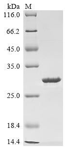 Greater than 90% as determined by SDS-PAGE.Recombinant Mouse Putative Hydrolase Rbbp9 (RBBP9) Protein (His&Myc)