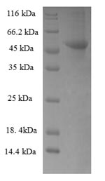 Greater than 90% as determined by SDS-PAGE.Recombinant Human Ribokinase (RBKS) Protein (His-SUMO)