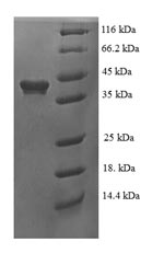 Greater than 90% as determined by SDS-PAGE.