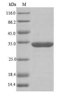 Greater than 85% as determined by SDS-PAGE.Recombinant Human Rna-Binding Motif Protein, X Chromosome (RBMX) Protein (GST)