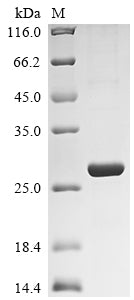 Greater than 90% as determined by SDS-PAGE.Recombinant Rat Retinol-Binding Protein 4 (RBP4) Protein (His)