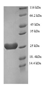 Greater than 90% as determined by SDS-PAGE.Recombinant Human Recoverin (RCVRN) Protein (His)