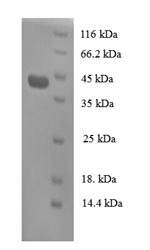 Greater than 90% as determined by SDS-PAGE.Recombinant Human Regenerating Islet-Derived Protein 3-Alpha (REG3A) Protein (GST)