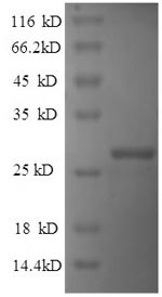 Greater than 90% as determined by SDS-PAGE.Recombinant Human Reelin (RELN) Protein (His)
