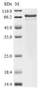 Greater than 85% as determined by SDS-PAGE.Recombinant Mouse Regulator Of G-Protein Signaling 14 (RGS14) Protein (His&Myc)