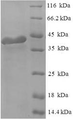 Greater than 90% as determined by SDS-PAGE.Recombinant Human Regulator Of G-Protein Signaling 2 (RGS2) Protein (His-SUMO)