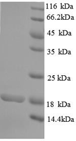 Greater than 90% as determined by SDS-PAGE.Recombinant Human Rhomboid-Related Protein 2 (RHBDL2) Protein (His)