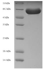 Greater than 90% as determined by SDS-PAGE.Recombinant Human Receptor-Interacting Serine/Threonine-Protein Kinase 2 (RIPK2) Protein (His)