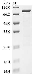 Greater than 85% as determined by SDS-PAGE.Recombinant Human Receptor-Interacting Serine/Threonine-Protein Kinase 2 (RIPK2) Protein (GST)