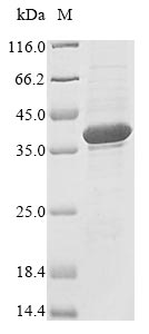 Greater than 85% as determined by SDS-PAGE.Recombinant Human Ribonuclease H1 (RNASEH1) Protein (His)