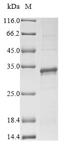 Greater than 85% as determined by SDS-PAGE.Recombinant Drosophila Melanogaster 60S Ribosomal Protein L10 (RPL10) Protein (His)